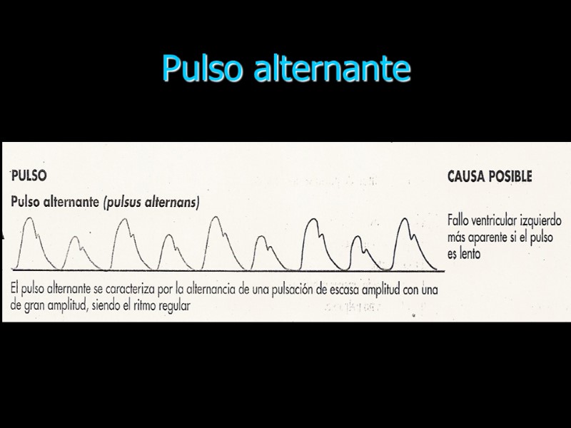 Pulso alternante